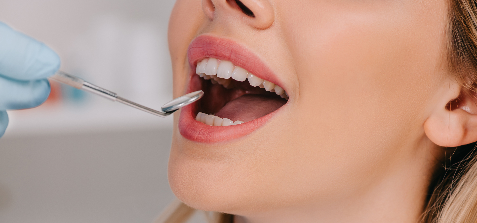 Tratamientos en Clínica Dental Uradent
