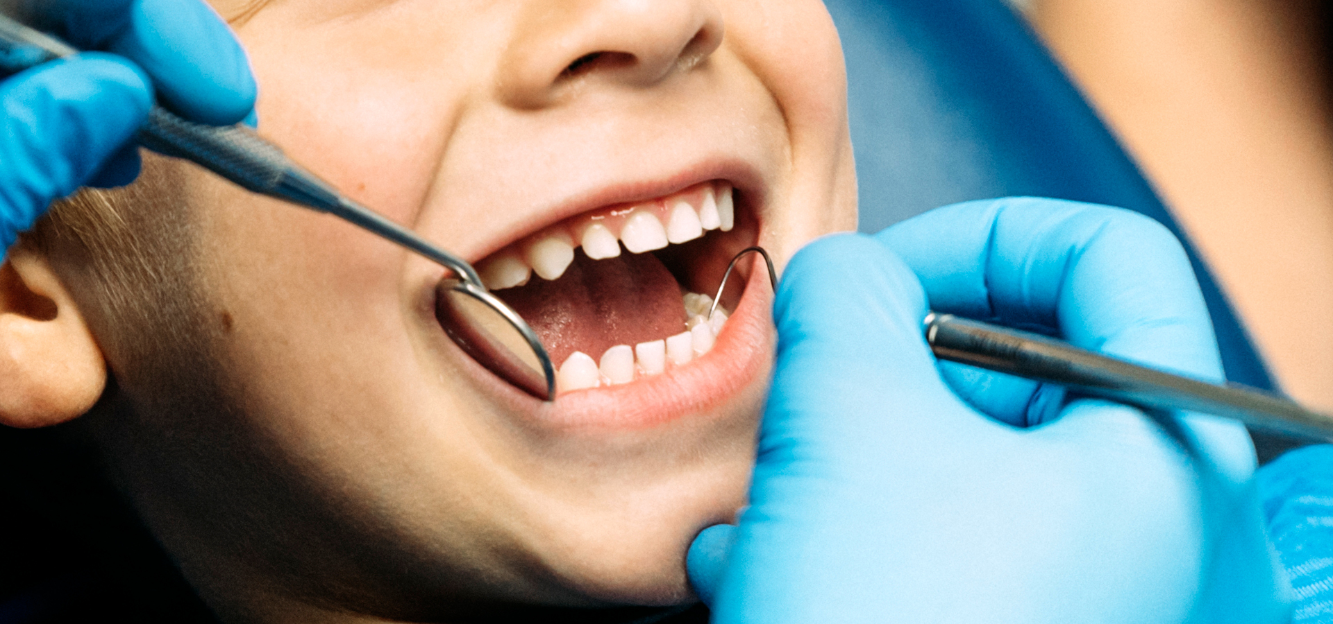 Clínica Dental Uradent tratamientos infantiles en Uradent odontopediatría